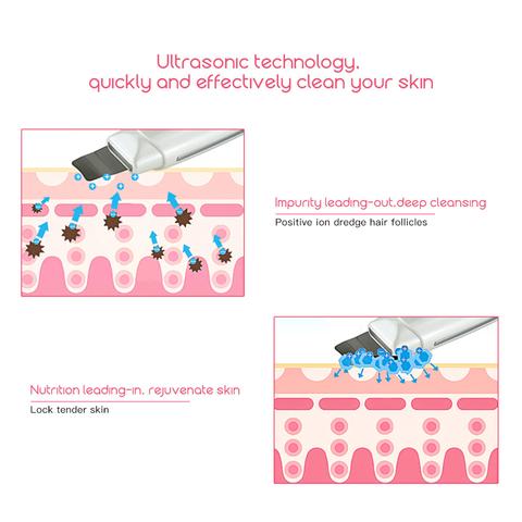 Ultrasonic Skin Scrubber Face Cleanser Blackhead Acne Removal Facial Spa Vibration Massager Ultrasound Peeling Clean Machine 394 - Image 4